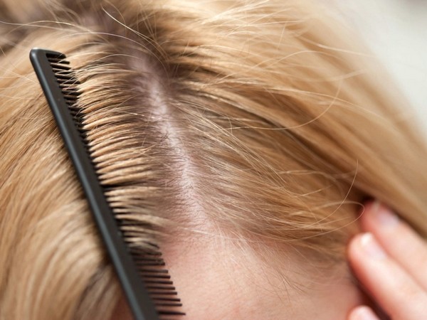 10 причин выпадения волос